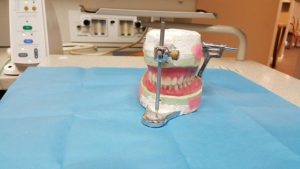 dentier prothese dentaire